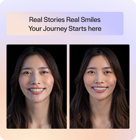 Trusted Client Testimonials & Smile Makeover Journeys of Real Stories, Real Smiles