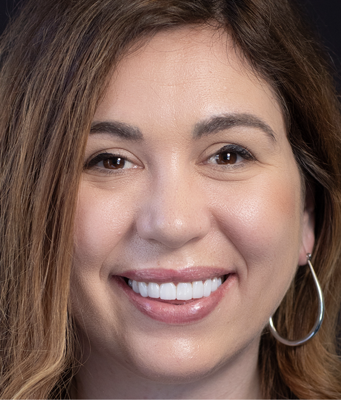 Close-up of woman smiling with Neer veneers
