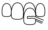 Line icon of neer veneer being placed