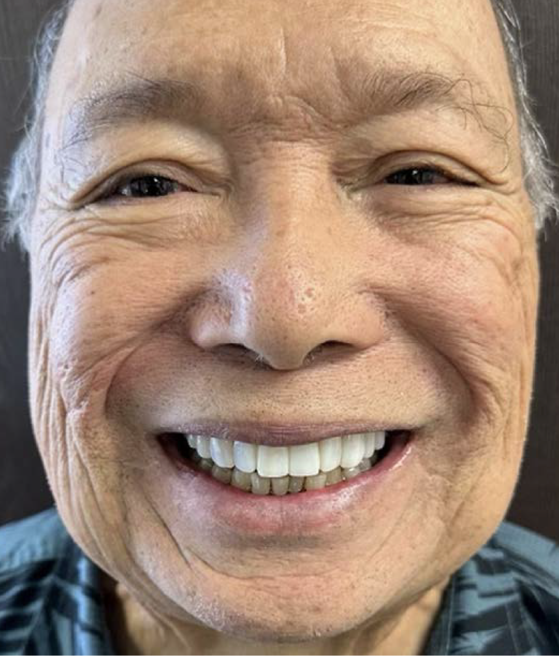 Close-up of man smiling with Neer veneers
