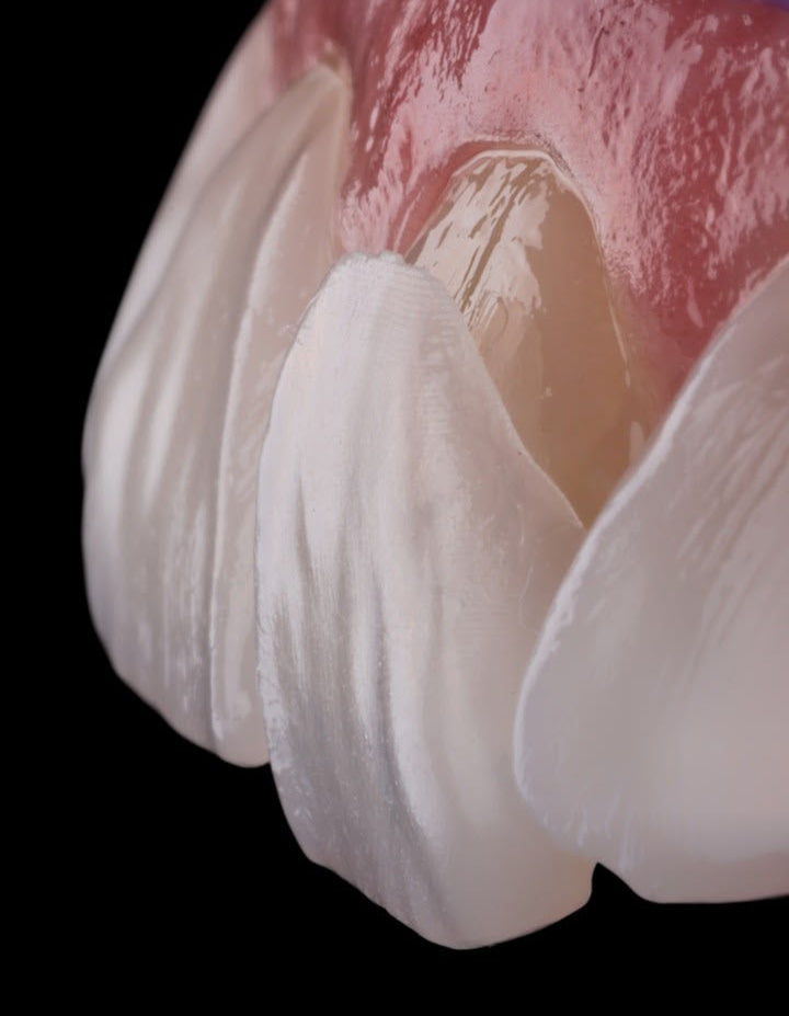 Macro view of Neer veneer against teeth